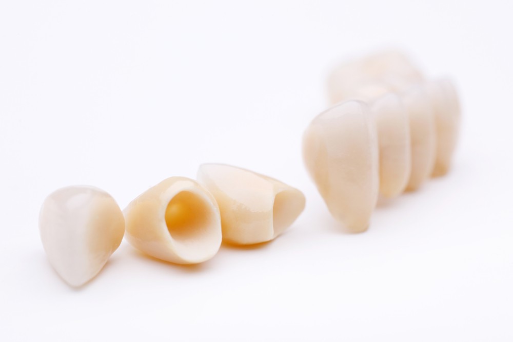 crowns-dentist-coconut-grove-fl