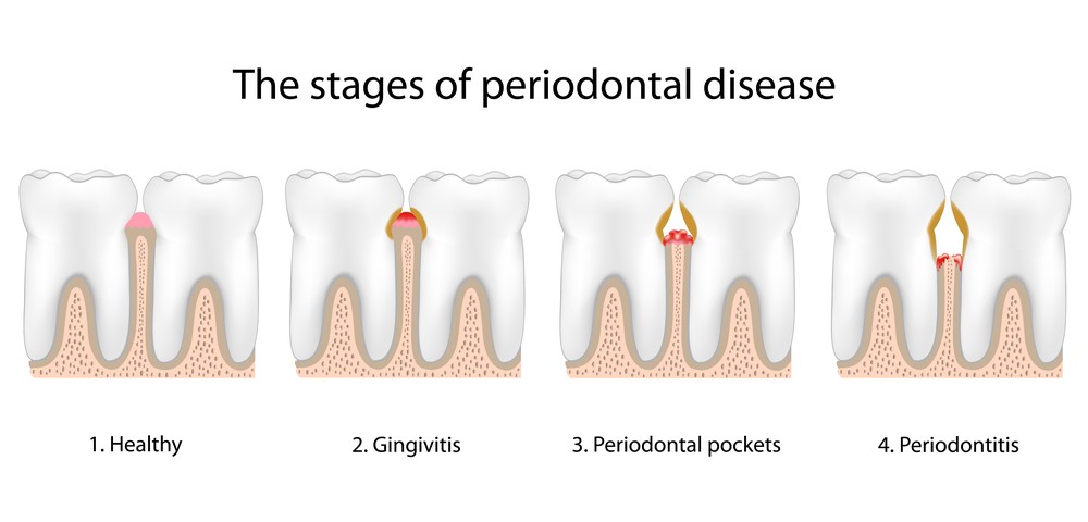 periodental-dentist-coconut-grove-fl