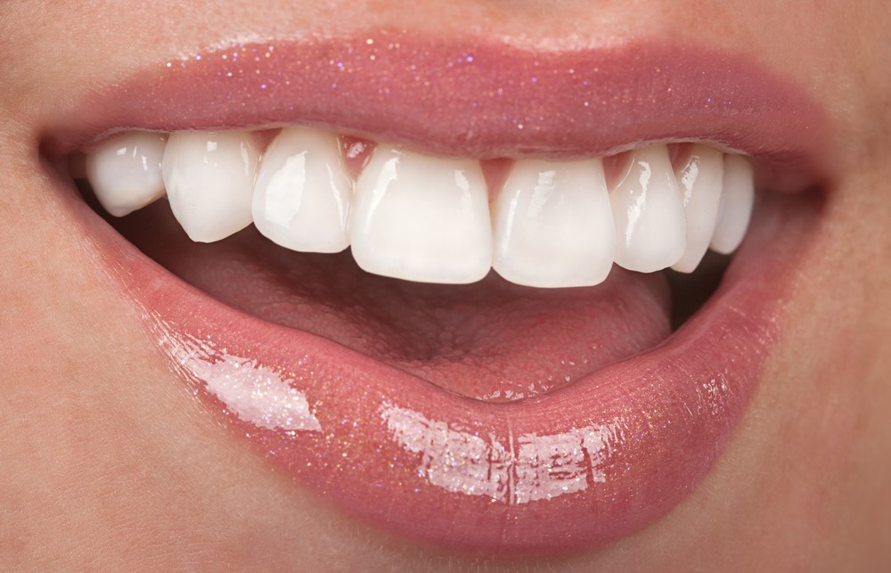 veneers-dentist-coconut-grove-miami-fl