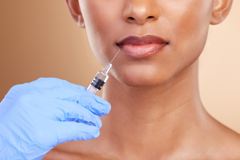 botox-grove-smiles-dentistry-dr-rita-dargham