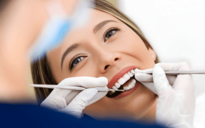 Transform Your Smile with Dental Bonding