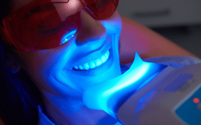 Benefits Professional Teeth Whitening